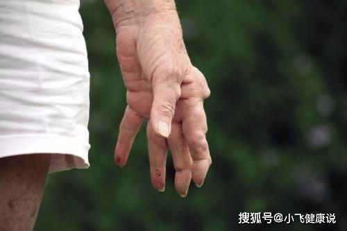 口腔潰瘍反復(fù)發(fā)作,或許是這6種疾病的預(yù)示,別忽視